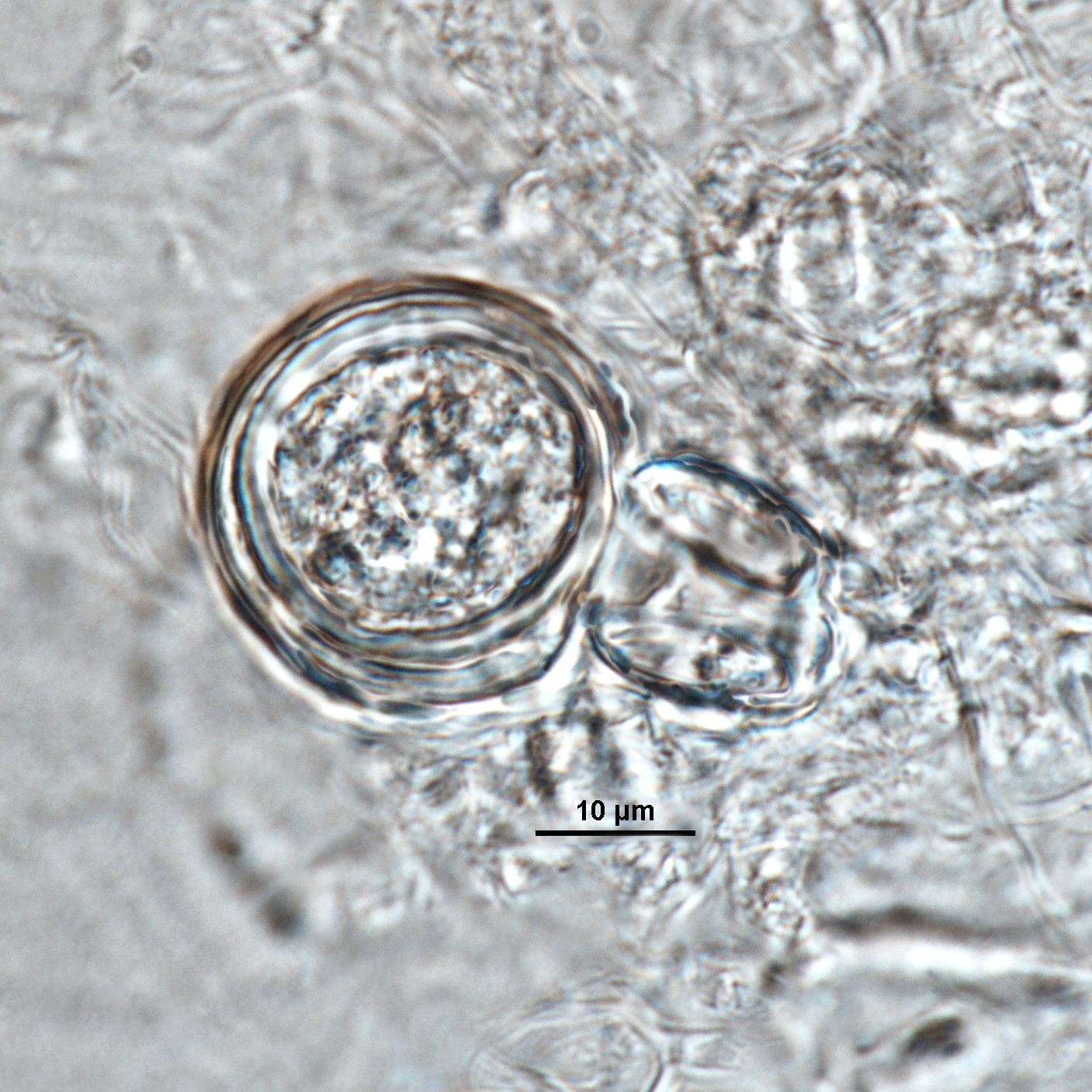   Phytophthora ramorum  (ex-type CPHST BL 55G)nbsp;sexual phase: plerotic oospore of ex-type (A1, EU1) produced with tester strain  P. capsici  (A2, ex-type CPHST BL 33); photo by Gloria Abad, USDA-APHIS-PPQ. 
